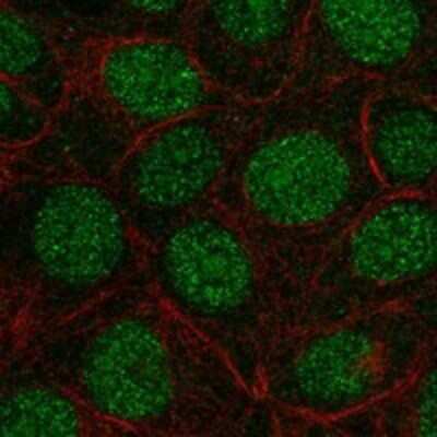 Immunocytochemistry/Immunofluorescence: FAM90A1 Antibody [NBP3-17367] - Staining of human cell line MCF7 shows localization to nucleoplasm & nucleoli.