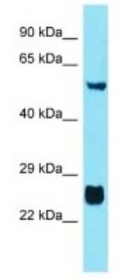 Western Blot: FAM90A10P Antibody [NBP3-09715] - Western blot analysis of FAM90A10P in Human A549 Whole Cell. Antibody dilution at 1ug/ml
