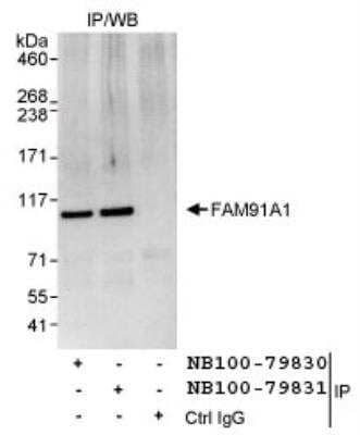 Immunoprecipitation: FAM91A1 Antibody [NB100-79831] - Detection of Human FAM91A1 by Western Blot of  Immunoprecipitates. Samples: Whole cell lysate (1 mg for IP,  20% of IP loaded) from HeLa cells. Antibodies: Affinity purified  rabbit anti-FAM91A1 antibody NB100-79831 used for IP at 3  mcg/mg lysate. FAM91A1 was also immunoprecipitated by  rabbit anti-FAM91A1 antibody NB100-79830, which recognizes an  upstream epitope.   Detection: Chemiluminescence with an exposure time of 3  seconds.
