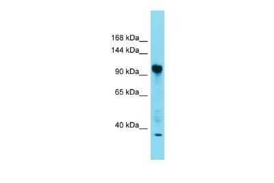 Western Blot: FAM91A1 Antibody [NBP2-87431] - Host: Rabbit. Target Name: FAM91A1. Sample Type: Fetal Heart lysates. Antibody Dilution: 1.0ug/ml