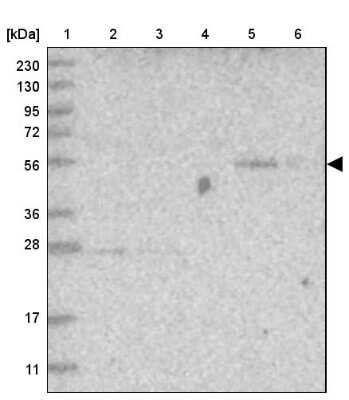 Western Blot: FAM98A Antibody [NBP1-85086] - Lane 1: Marker  [kDa] 230, 130, 95, 72, 56, 36, 28, 17, 11.  Lane 2: Human cell line RT-4.  Lane 3: Human cell line U-251MG sp.  Lane 4: Human plasma (IgG/HSA depleted).  Lane 5: Human liver tissue.  Lane 6: Human tonsil tissue