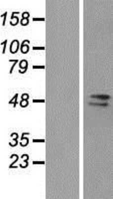 Western Blot: FAM98A Overexpression Lysate (Adult Normal) [NBP2-07167] Left-Empty vector transfected control cell lysate (HEK293 cell lysate); Right -Over-expression Lysate for FAM98A.