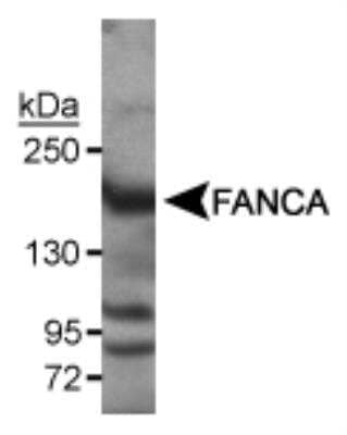 Western Blot: FANCA Antibody [NB110-98673] - Detection of FANCA in 293 EBNA cell lysates using NB110-98673.