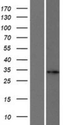 Western Blot: FANCA Overexpression Lysate (Adult Normal) [NBP2-08666] Left-Empty vector transfected control cell lysate (HEK293 cell lysate); Right -Over-expression Lysate for FANCA.