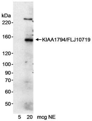 Western Blot: FANCI Antibody [NB300-244] - Nuclear extract (5 and 20 ug) from HeLa cells. Antibody used at 0.2 ug/ml.