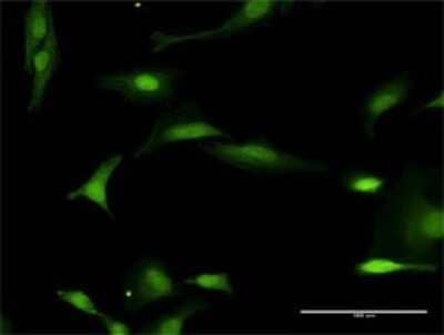 Immunocytochemistry/Immunofluorescence: FANCL Antibody [H00055120-D01] - Analysis of antibody to FANCL on HeLa cell. Antibody concentration 30 ug/ml.
