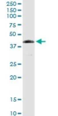 Western Blot: FANCL Antibody [H00055120-D01P] - Analysis of FANCL expression in human spleen.