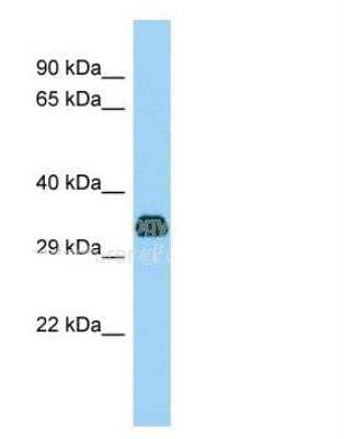 Western Blot: FANK1 Antibody [NBP2-59799] - Sample Type: Rat pancreas lysates at  antibody Dilution of 1.0ug/ml