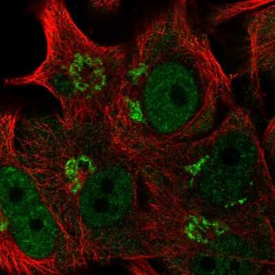 Immunocytochemistry/Immunofluorescence: FAPP2 Antibody [NBP2-55932] - Staining of human cell line SK-MEL-30 shows localization to nucleoplasm & the Golgi apparatus.