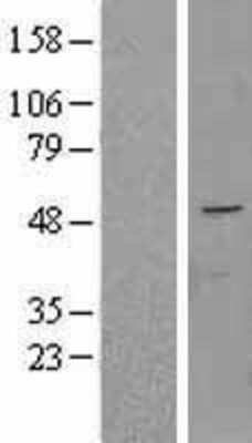 Western Blot: FAPP2 Overexpression Lysate (Adult Normal) [NBL1-14505] Left-Empty vector transfected control cell lysate (HEK293 cell lysate); Right -Over-expression Lysate for FAPP2.