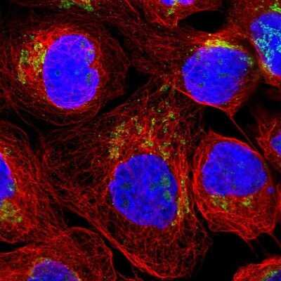 Immunocytochemistry/Immunofluorescence: FAR2 Antibody [NBP1-90435] - Staining of human cell line A-431 shows localization to nucleoli & the Golgi apparatus. Antibody staining is shown in green.