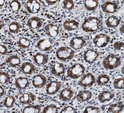 Immunohistochemistry-Paraffin: FAR2 Antibody [NBP1-90435] - Staining of human rectum shows strong granular cytoplasmic positivity in glandular cells.