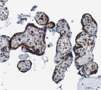 Immunohistochemistry-Paraffin: FAR2 Antibody [NBP1-90435] - Staining of human placenta shows strong granular cytoplasmic positivity in trophoblastic cells.