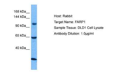 Western Blot: FARP1 Antibody [NBP2-88814] - Host: Rabbit. Target Name: FARP1. Sample Tissue: Human DLD1 Whole Cell. Antibody Dilution: 1.0ug/ml