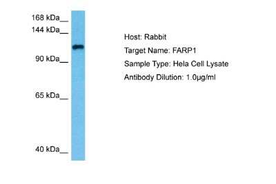 Western Blot: FARP1 Antibody [NBP2-88816] - Host: Rabbit. Target Name: FARP1. Sample Tissue: Human Hela Whole Cell lysates. Antibody Dilution: 1ug/ml