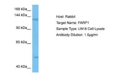 Western Blot: FARP1 Antibody [NBP2-88817] - Host: Rabbit. Target Name: FARP1. Sample Tissue: Human LN18 Whole Cell lysates. Antibody Dilution: 1ug/ml