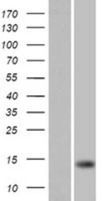 Western Blot: FARP1 Overexpression Lysate (Adult Normal) [NBP2-08953] Left-Empty vector transfected control cell lysate (HEK293 cell lysate); Right -Over-expression Lysate for FARP1.