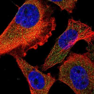 Immunocytochemistry/Immunofluorescence: FARP2 Antibody [NBP2-57178] - Staining of human cell line U-251 MG shows localization to cytosol.