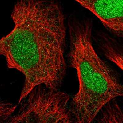 Immunocytochemistry/Immunofluorescence: FARSB Antibody [NBP1-83923] - Immunofluorescent staining of human cell line U-2 OS shows localization to nucleus.