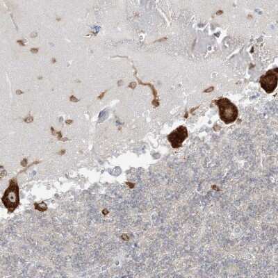 Immunohistochemistry: FARSB Antibody [NBP2-38314] - Staining of human cerebellum shows strong cytoplasmic positivity in Purkinje cells.