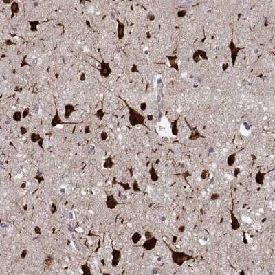 Immunohistochemistry: FARSB Antibody [NBP2-38917] - Staining of human cerebral cortex shows strong cytoplasmic positivity in neuronal cells and glial cells.