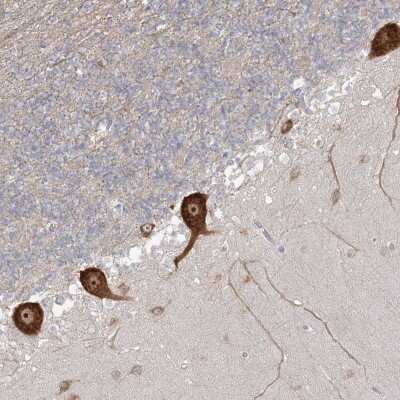 Immunohistochemistry-Paraffin: FARSB Antibody [NBP1-83923] - Staining of human cerebellum shows strong cytoplasmic positivity in purkinje cells.