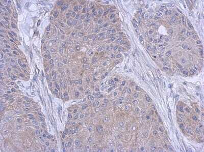 Immunohistochemistry-Paraffin: FARSB Antibody [NBP2-16430] - Immunohistochemical analysis of paraffin-embedded Cal27 xenograft, using antibody at 1:500 dilution.