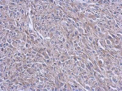 Immunohistochemistry-Paraffin: FARSB Antibody [NBP2-16430] - Immunohistochemical analysis of paraffin-embedded RT2 xenograft, using antibody at 1:500 dilution.