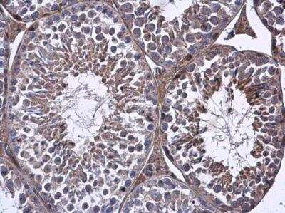 Immunohistochemistry-Paraffin: FARSB Antibody [NBP2-16430] - FARSB antibody detects FARSB protein at cytoplasm in mouse testis by immunohistochemical analysis. Sample: Paraffin-embedded mouse testis. FARSB antibody diluted at 1:500.