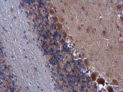 Immunohistochemistry-Paraffin: FARSB Antibody [NBP2-16430] - FARSB antibody detects FARSB protein at cytoplasm in mouse brain by immunohistochemical analysis. Sample: Paraffin-embedded mouse brain. FARSB antibody diluted at 1:500.