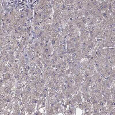 Immunohistochemistry-Paraffin: FARSB Antibody [NBP2-38917] - Staining of human liver shows low expression as expected.