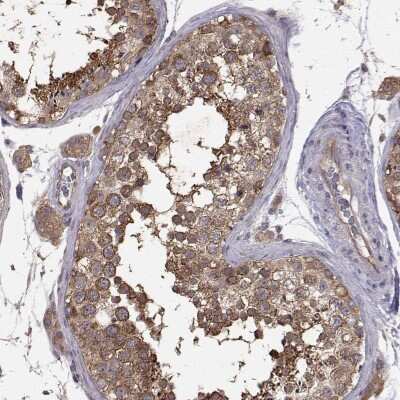 Immunohistochemistry-Paraffin: FARSB Antibody [NBP2-38917] - Staining of human testis shows high expression.