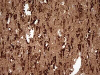 Immunohistochemistry: FARSB Antibody (OTI4B3) - Azide and BSA Free [NBP2-71539] - Analysis of Human adult brain tissue. (Heat-induced epitope retrieval by 1 mM EDTA in 10mM Tris, pH8.5, 120C for 3min)