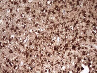 Immunohistochemistry: FARSB Antibody (OTI4B3) - Azide and BSA Free [NBP2-71539] - Analysis of Human embryonic brain cortex tissue. (Heat-induced epitope retrieval by 1 mM EDTA in 10mM Tris, pH8.5, 120C for 3min)