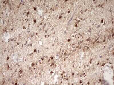 Immunohistochemistry: FARSB Antibody (OTI4B3) - Azide and BSA Free [NBP2-71539] - Analysis of Human embryonic cerebellum tissue. (Heat-induced epitope retrieval by 1 mM EDTA in 10mM Tris, pH8.5, 120C for 3min)