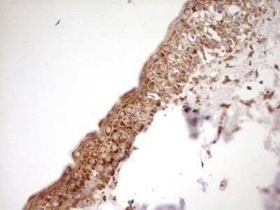 Immunohistochemistry: FARSB Antibody (OTI4B3) - Azide and BSA Free [NBP2-71539] - Analysis of Human skin tissue. (Heat-induced epitope retrieval by 1 mM EDTA in 10mM Tris, pH8.5, 120°C for 3min)