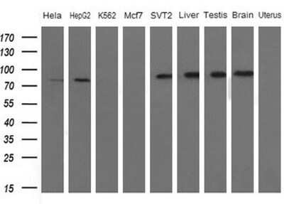 Western Blot: FARSB Antibody (OTI4B3) - Azide and BSA Free [NBP2-71539] - Analysis of extracts (10ug) from 5 different cell lines and 4 human tissue (1: Hela; 2: HepG2; 3: K562; 4: Mcf7; 5: SVT2; 6: Liver; 7: Testis; 8: Brain; 9: Uterus)