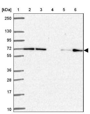 Western Blot FARSB Antibody