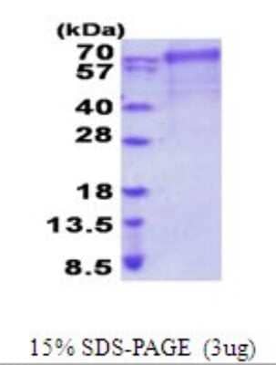 SDS-PAGE Recombinant Human FARSB His Protein