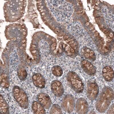 Immunohistochemistry-Paraffin: FASTKD1 Antibody [NBP2-14009] - Staining of human small intestine shows moderate granular cytoplasmic positivity in glandular cells.