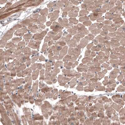 Immunohistochemistry-Paraffin: FASTKD1 Antibody [NBP2-14009] - Staining of human heart muscle shows moderate cytoplasmic positivity in cardiomyocytes.