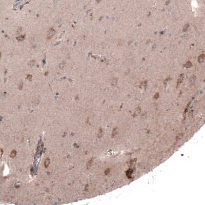 Immunohistochemistry-Paraffin: FASTKD1 Antibody [NBP2-14009] - Staining of human cerebral cortex shows moderate granular cytoplasmic positivity in neurons.