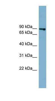 Western Blot: FASTKD2 Antibody [NBP1-55360] - 721_B cell lysate, concentration 0.2-1 ug/ml.