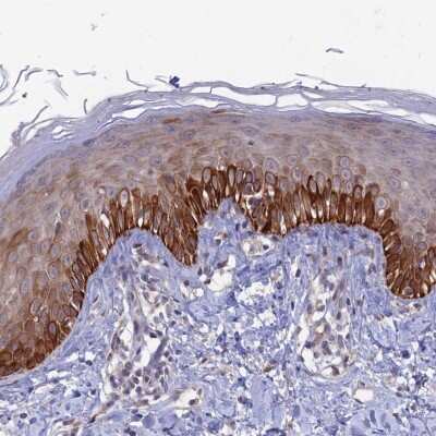 Immunohistochemistry-Paraffin: FASTKD5 Antibody [NBP1-91888] - Staining of human skin shows strong cytoplasmic positivity in keratinocytes.