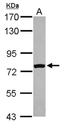 Western Blot: FASTKD5 Antibody [NBP2-16435] - Sample (30 ug of whole cell lysate) A: A431 7. 5% SDS PAGE gel, diluted at 1:1000.
