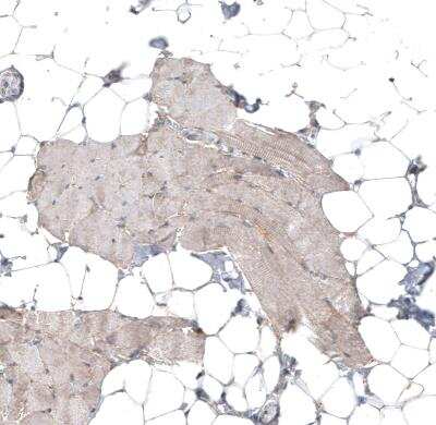 Immunohistochemistry-Paraffin: FAT1 Antibody [NBP1-84565] - Staining of human skeletal muscle shows very weak positivity in myocytes.