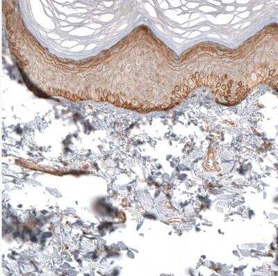 Immunohistochemistry-Paraffin: FAT1 Antibody [NBP1-84565] - Staining of human skin shows moderate membranous positivity in squamous epithelial cells.