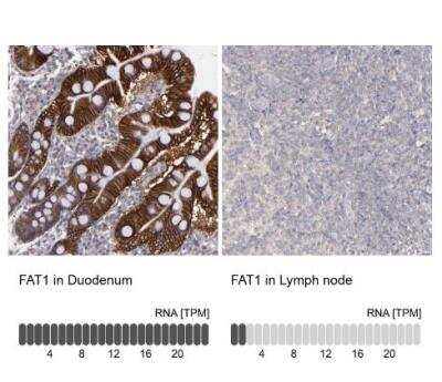 Immunohistochemistry-Paraffin: FAT1 Antibody [NBP1-84566] - Analysis in human duodenum and lymph node tissues using NBP1-84566 antibody. Corresponding FAT1 RNA-seq data are presented for the same tissues.