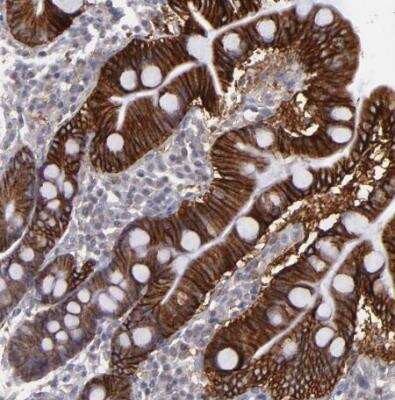 Immunohistochemistry-Paraffin: FAT1 Antibody [NBP1-84566] - Staining of human duodenum shows strong cytoplasmic positivity in glandular cells.