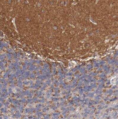 Immunohistochemistry-Paraffin: FAT1 Antibody [NBP1-84566] - Staining of human cerebellum shows strong cytoplasmic positivity in granular layer.